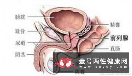 专家揭秘男性患前列腺癌的五大常见症状