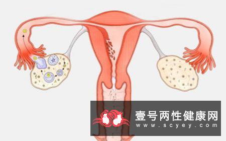 不孕症有什么症状_39健康问答