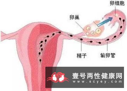 不孕症有什么症状_39健康问答