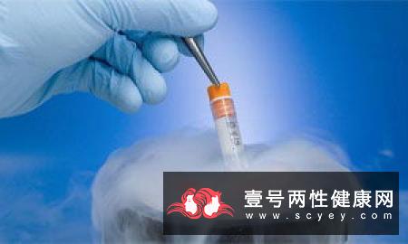 试管婴儿(IVF)是体外受精