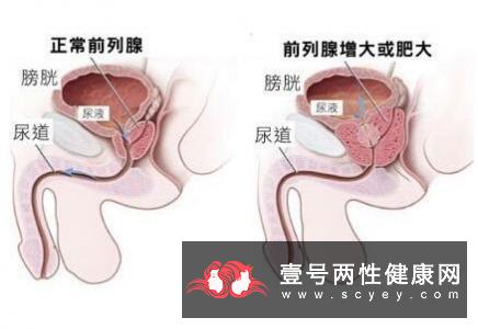 广州多家大医院均有针对男性健康的义诊和咨询活动