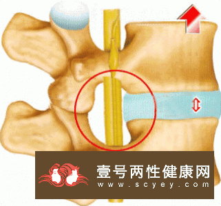 男人腰酸怎么回事？应该注意什么