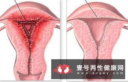 如何保护前列腺？要经常食用这些食物