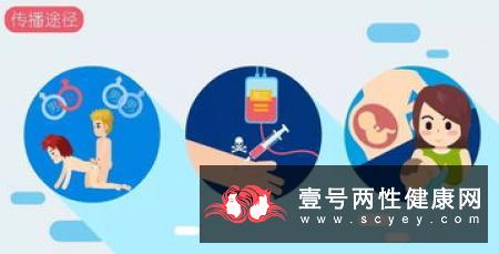 同性性行为容易得病吗