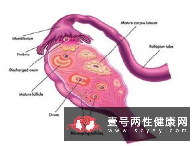 为什么会双侧卵巢多囊样改变?