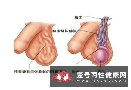 婚后一直同居未有小孩者,若妻子经检查没问题,男方应该及时去医院检查,以便查出