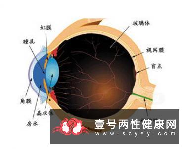 白内障主要是因为什么原因产生的