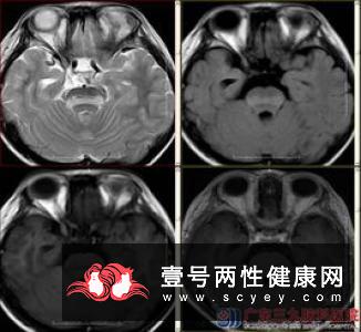 营养不良的各种身体信号