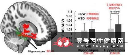 防治老年痴呆症的十种食疗方