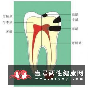 老人如何保护好牙齿健康  日常吃哪些食物好