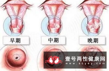 老年性痴呆的主要症状都有哪些?